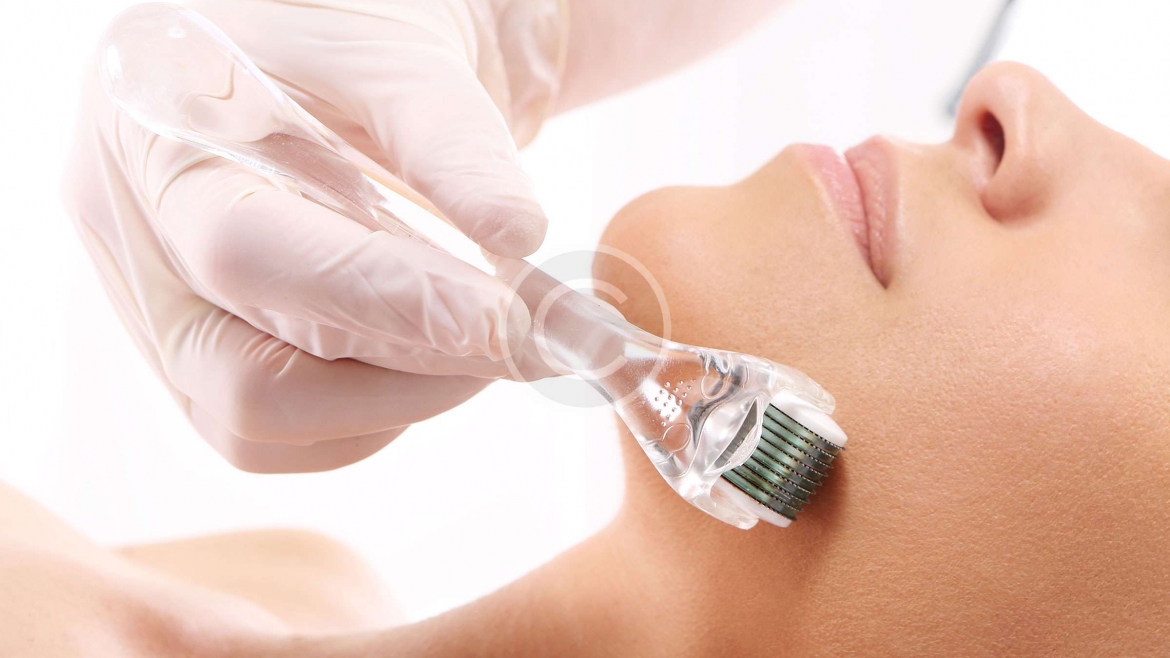 Mesotherapy