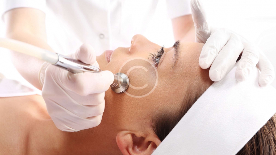 Microdermabrasion